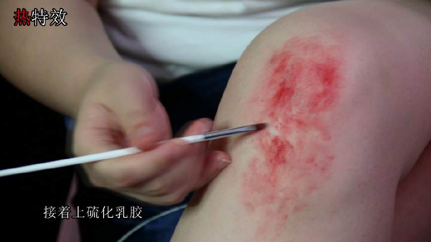 膝关节损伤揭秘,膝盖损伤科普动画视频