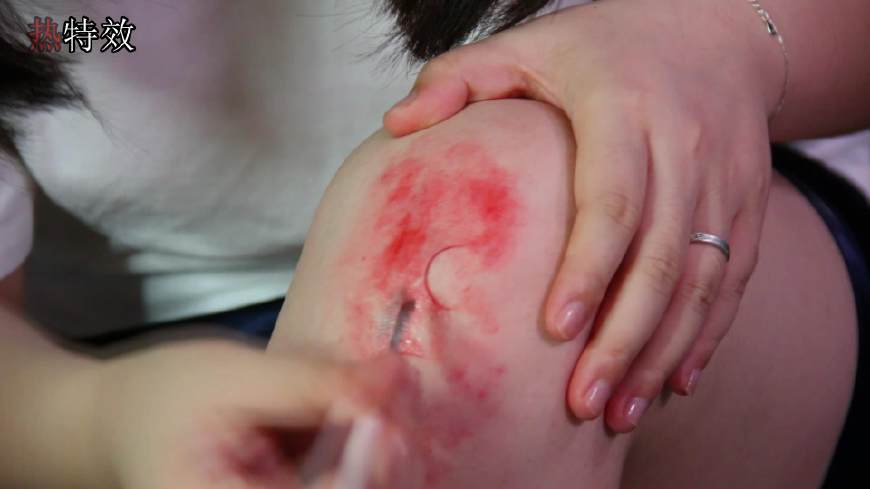 膝关节损伤揭秘,膝盖损伤科普动画视频