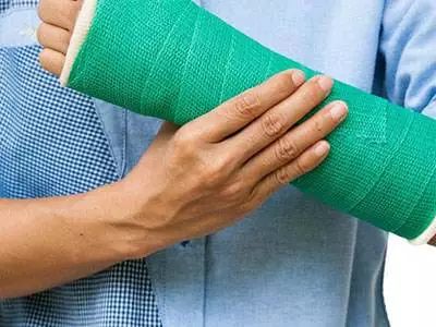 骨折后锻炼身体可以加速骨折愈合,肋骨骨折愈合期二次骨折症状