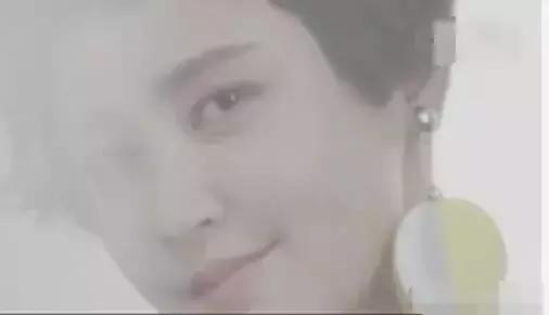 张歆艺打了玻尿酸后的样子,张歆艺下巴打了玻尿酸