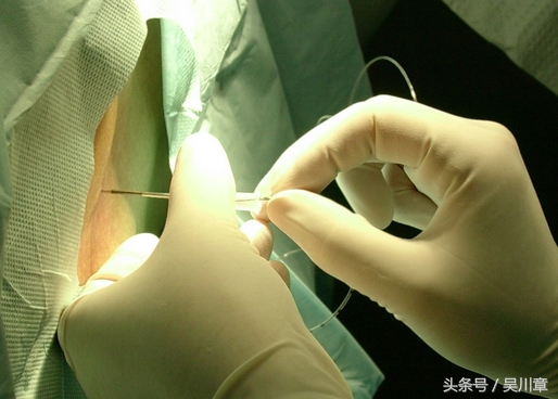 分娩中医镇痛,分娩镇痛倡导顺产让母爱回归自然