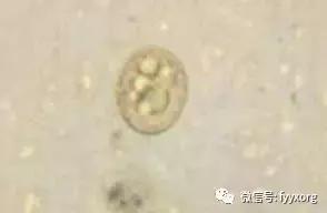 猪寄生虫最佳防治方法,猪寄生虫怎么鉴别图片