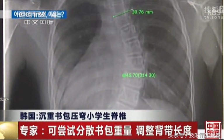 小事不小：莫让沉重的书包，压住孩子成长的脚步