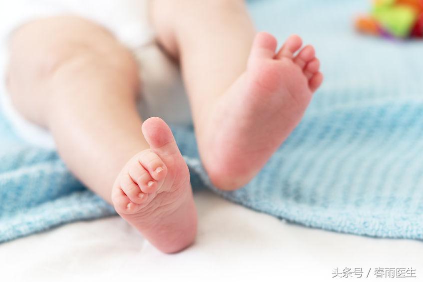 走路罗圈腿怎么治疗,罗圈腿x型腿现在好治吗