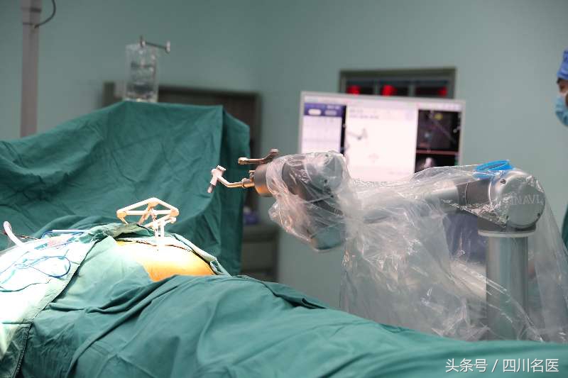 我国手术机器人,国内骨科手术机器人精准度