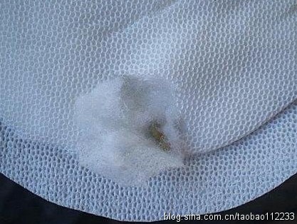 卫生巾要不要经常换,如果卫生巾过了很久没换会怎么样