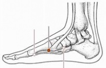 推拿治疗胃脘痛的推拿处方,胃脘痛的针灸处方及操作