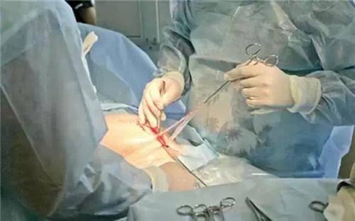 想剖宫产可没那么简单,必须符合以下14条指征,否则只能自然分娩