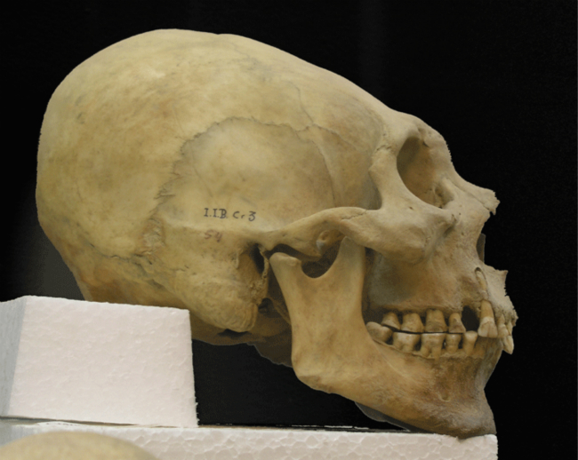 人的头骨为什么形状差别这么大,人类头骨之谜揭秘