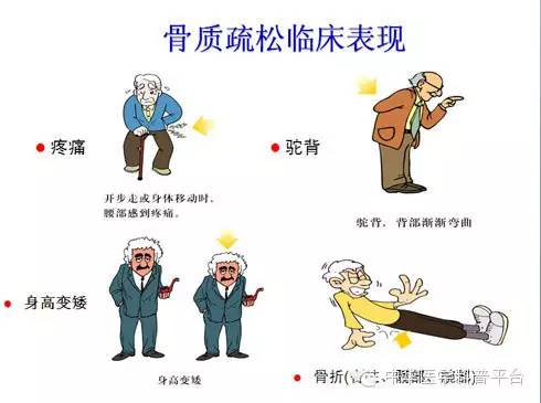 补钙最好的4大误区,补钙越多越好这三个误区要避开