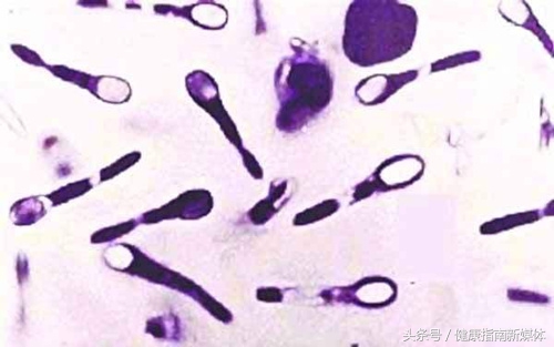 踩了生锈的钉子一定会得破伤风,踩到带锈的铁钉一定会得破伤风吗