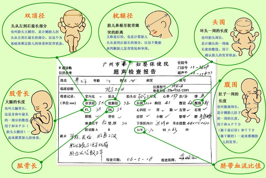 图解B超单，一分钟教准妈妈看懂宝宝状况