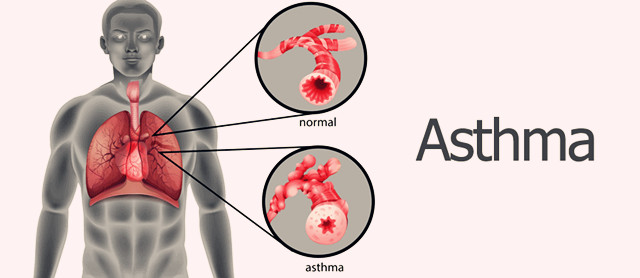 表邪化热传肺，汗出而喘，可以选用麻杏石膏汤