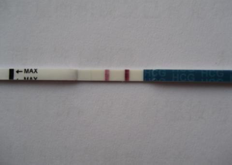 想尿但是尿不出来是肾虚吗,想尿又尿不出肾不好吗