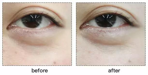 refacaratray瘦脸滚轮美容仪,refa进口滚轮瘦脸仪