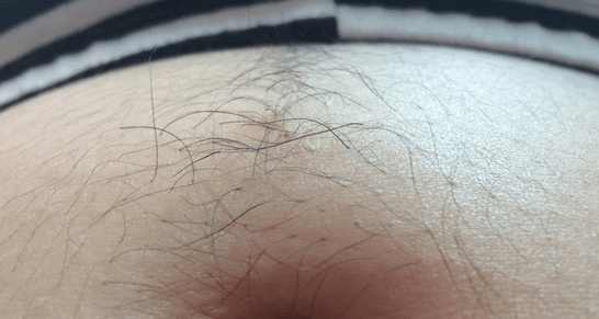 艰辛怀上双胞胎,艰辛孕育孩子