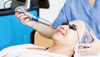 医美去黑头小妙招,医美去黑头有多少种方法