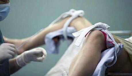 做什么检查能看出女人流产过几次,一个人可以做流产多少次