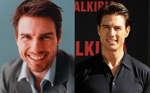 矫正牙齿过程中会出现的问题,矫正过程中牙齿出现反弹