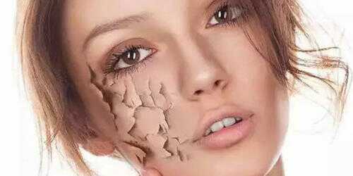 脸上毛孔里挤出白色条状是螨虫吗,脸上长螨虫的表现你中招了吗