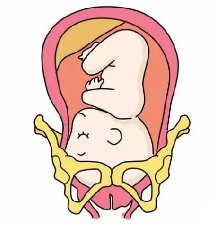 胎儿一动就感觉有尿意是入盆,怀孕32周感觉胎儿入盆了