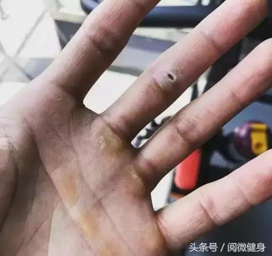 早就说你们别“撸”那么多，后悔了吧，瞅瞅这一个个的手……啧啧