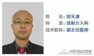 卵巢囊肿(及巧克力囊肿),放射介入副主任医师给你的治疗方案