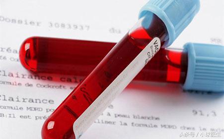 透析了，就不要再管肌酐高低了？！