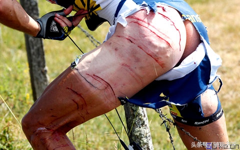 骑行受伤的十大技巧,骑行时发生事故后的做法是正确的