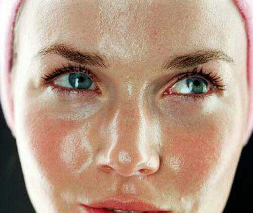 脸上毛孔里挤出白色条状是螨虫吗,脸上长螨虫的表现你中招了吗