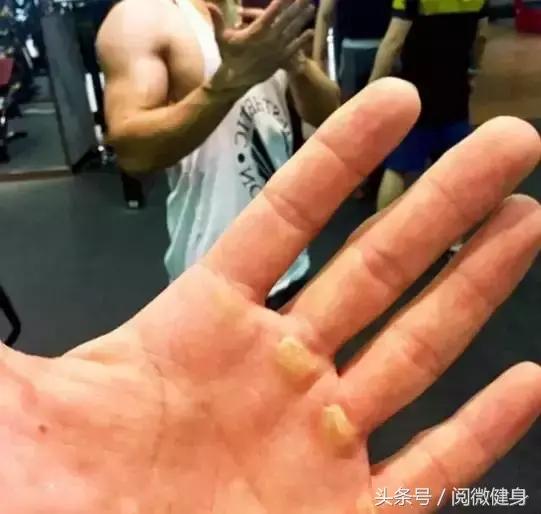 早就说你们别“撸”那么多，后悔了吧，瞅瞅这一个个的手……啧啧