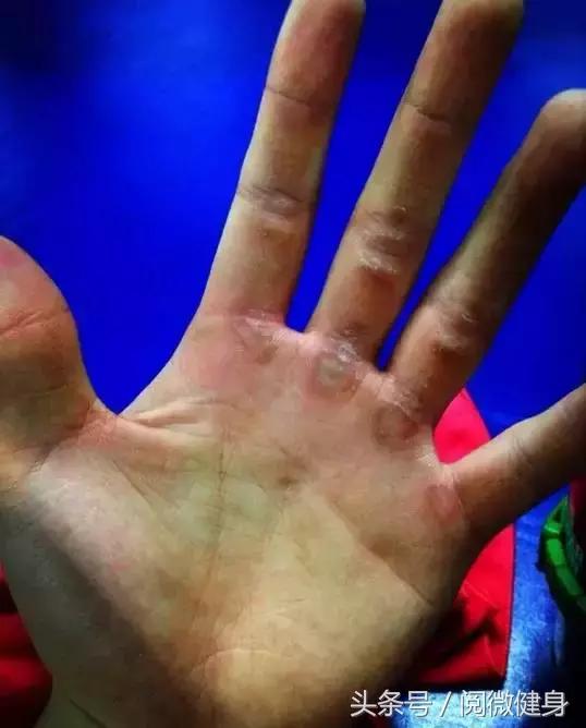 早就说你们别“撸”那么多，后悔了吧，瞅瞅这一个个的手……啧啧