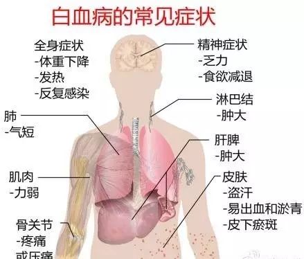 cart白血病治愈案例,白血病m4中医治愈案例