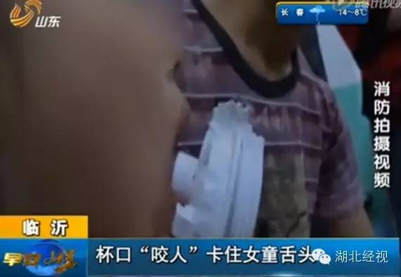 6岁宝宝喝水,不慎将舌头卡住瓶盖至血肿僵硬