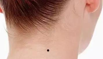 黑痣变红痣有问题吗,黑痣红痣突然变大增多是什么原因