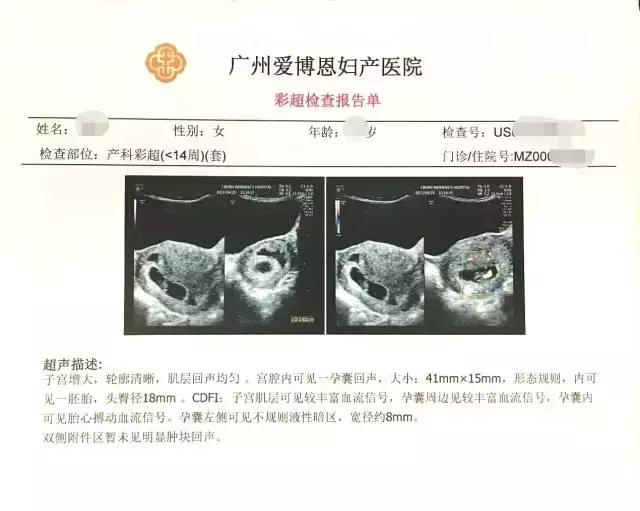 喜获两条杠什么意思,怎样才能获得两道杠