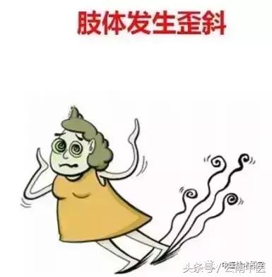 脑血栓前兆有10个表现,脑血栓有前兆当心这7个症状