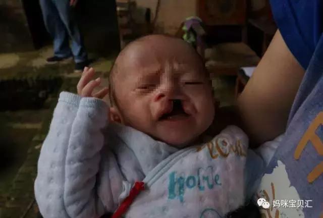 孕妇什么检查可以看出婴儿腭裂,孕检查出胎儿有问题但坚持生下