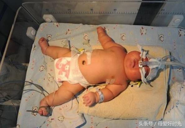 600多斤的孕妇生产，婴儿出生后让助产医生难以置信！