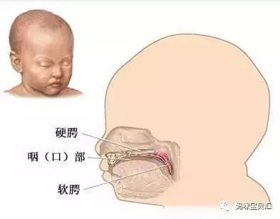 孕妇什么检查可以看出婴儿腭裂,孕检查出胎儿有问题但坚持生下