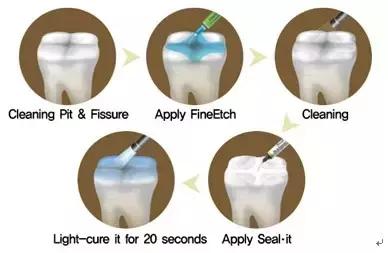 蛀牙的修补和牙齿矫正的问题,爱牙日公益讲座视频