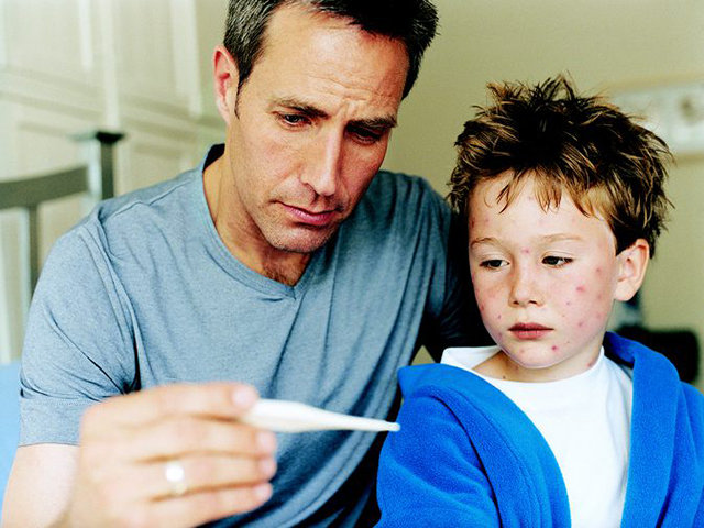 儿童水痘是怎么引起的,孩子得水痘大人如何避免传染