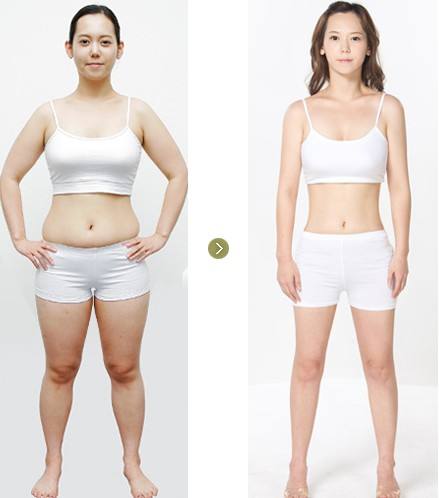 妇产科剖腹产产后修复疗程,产妇坐月子如何在崩溃中自愈