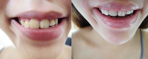 小苏打是用多功能的还是食用的,日常生活中小苏打的10个家庭用途