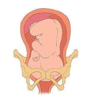 孕晚期“肚子痛”代表要生了?孕晚期腹痛的原因有哪些?