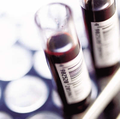 等有了尿毒症的前兆后要怎么办,一旦引起尿毒症还能逆转吗