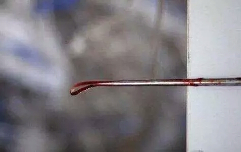 引产和无痛人流哪个危害大,引产不清宫是不是伤害没有那么大