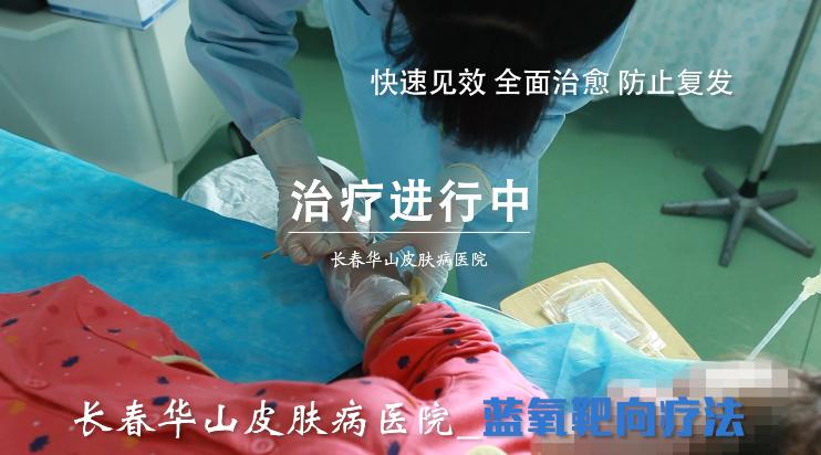 劝告：我现在就告诉你这样追求美，白癜风肯定会恋上你