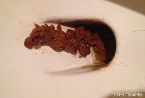 女性湿气重的6大征兆,湿气重的女性常有3个表现