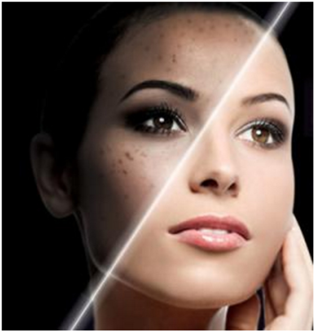 不复发黄褐斑怎么治疗,褐斑用什么治最好